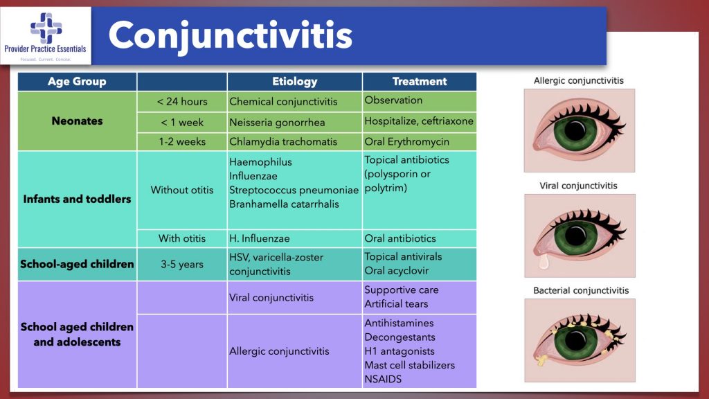 Conjunctivitis