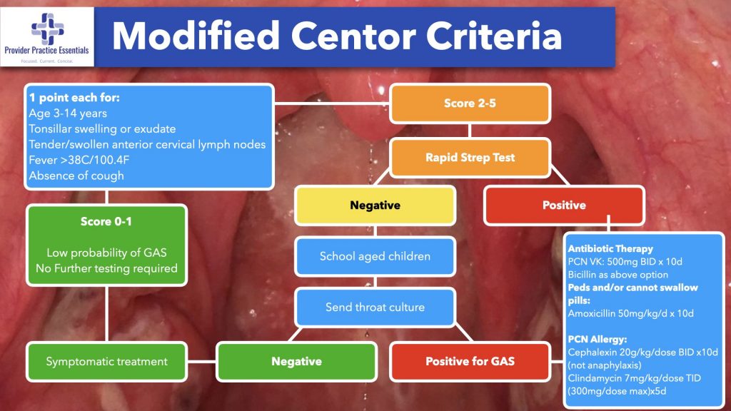 Modified Centor Criteria