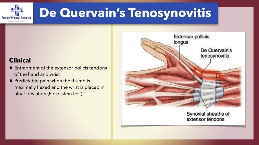 Tendonitis, Repetitive motion disorder