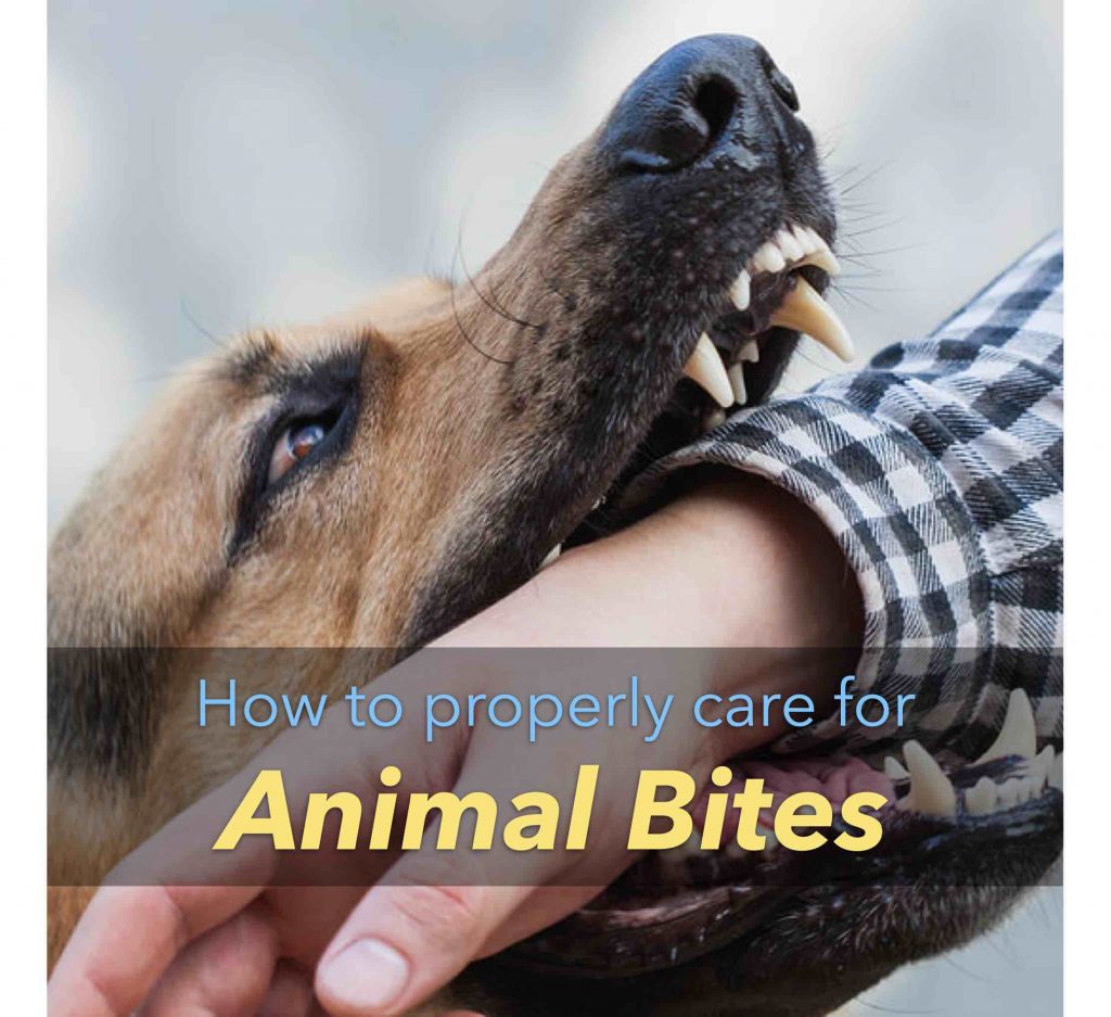 How to properly care for animal bites
