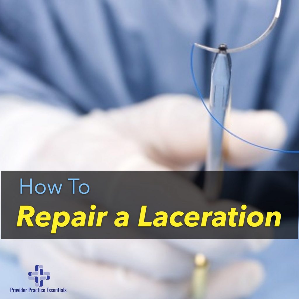 How to repair a laceration