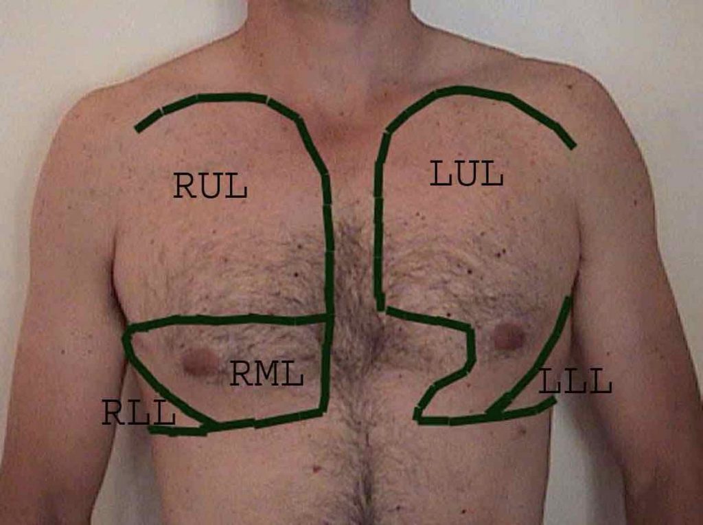 Location of anterior lung lobes
