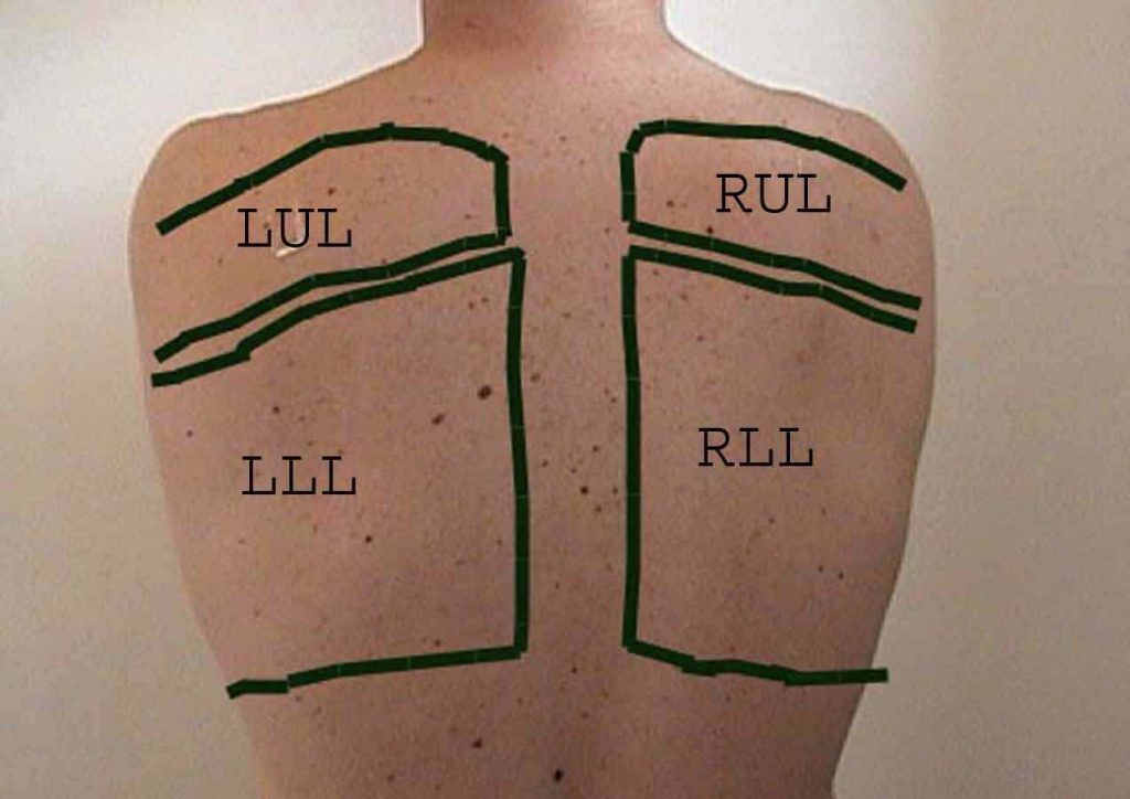 location of posterior lung lobes
