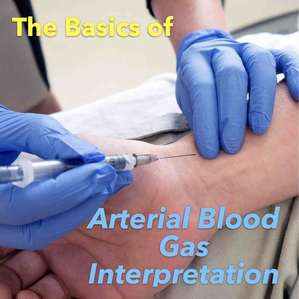 The Basics of Arterial Blood Gas Interpretation