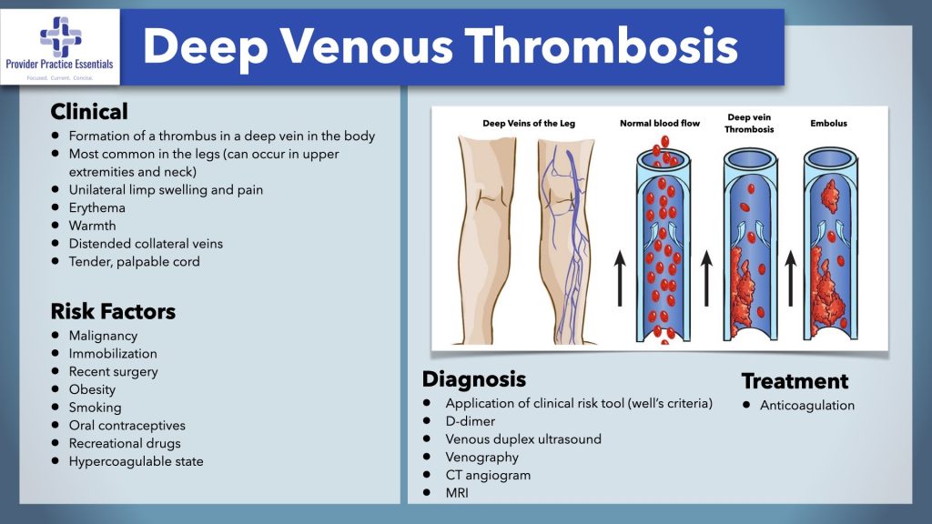 Deep Venous Thrombosis