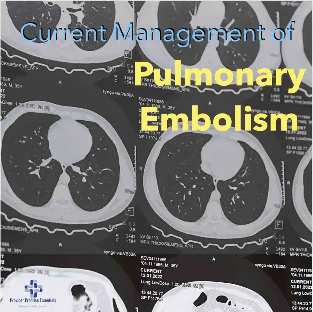 Pulmonary Embolism