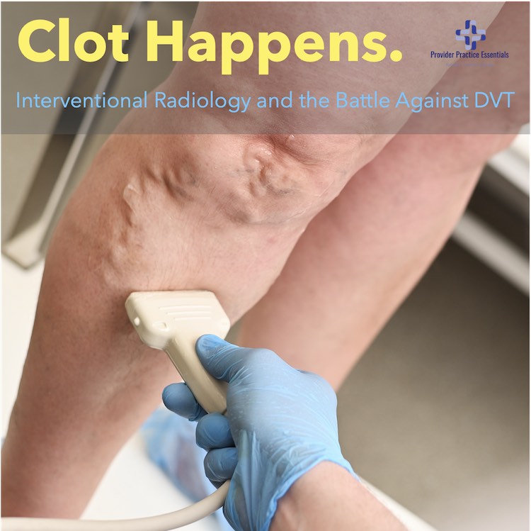 Clot Happens: Interventional Radiology and the Battle Against DVT