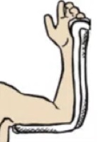 Posterior Long Arm Splint
